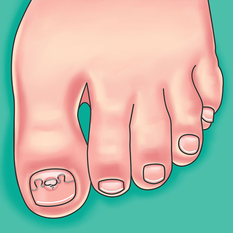 korrekcionnaya_sistema