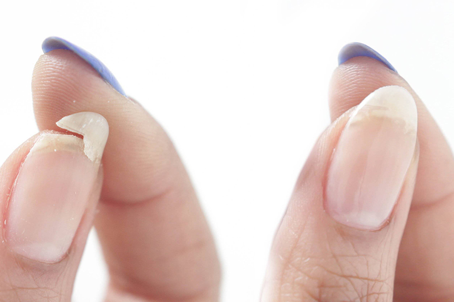 Как восстановить ноготь? Реконструкция ногтей в 3 этапа