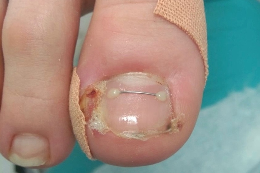 Распространенные проблемы ногтей у детей и как с ними справиться