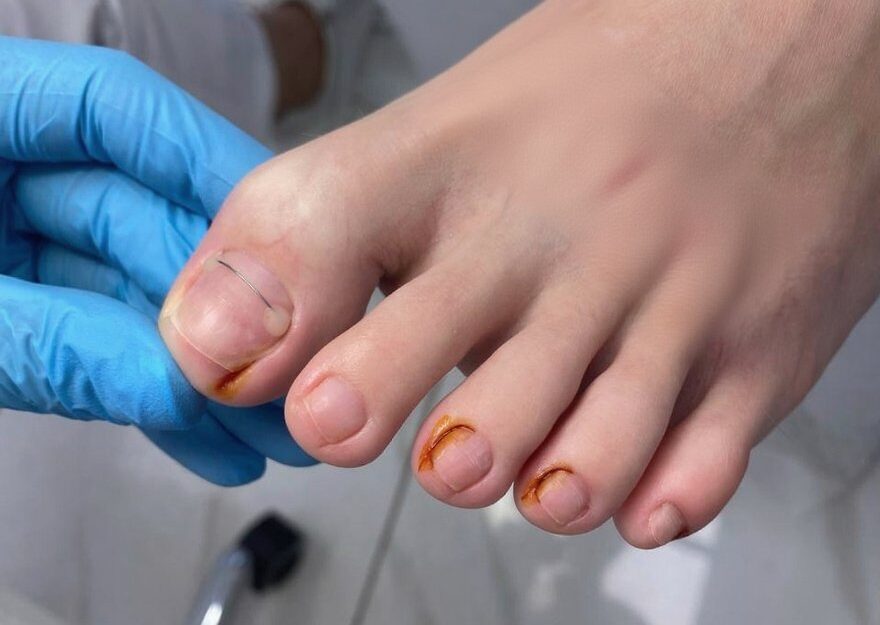 Детская подология: когда стоит обратиться к специалисту